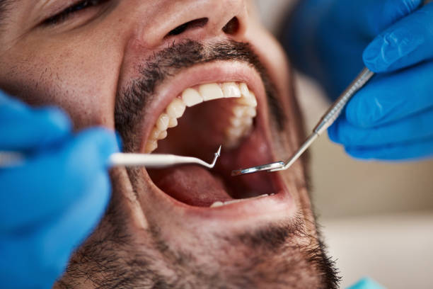 Best Emergency Dental Care for Abscessed Tooth in White Horse, NJ